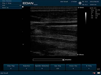 EDAN U50 VET