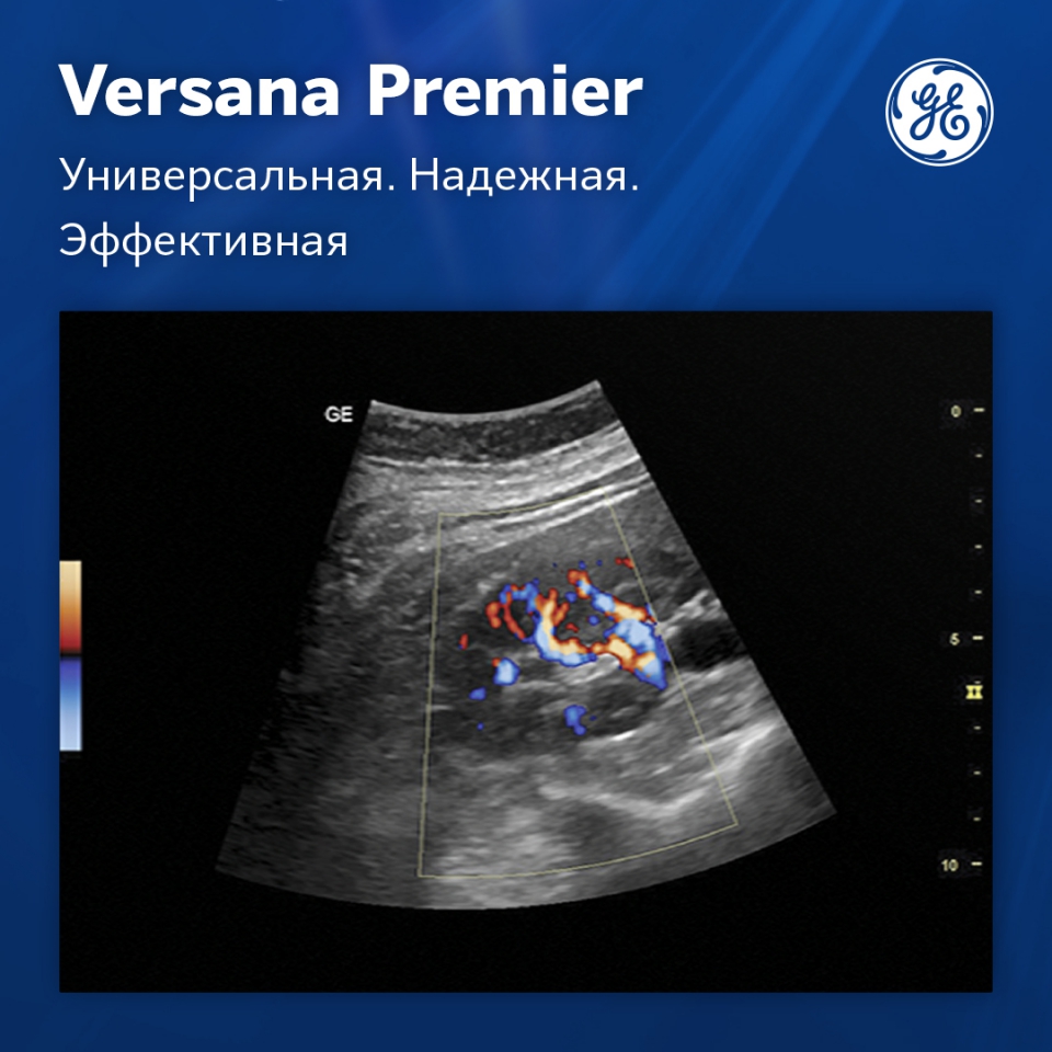 GE Versana Premier Platinum