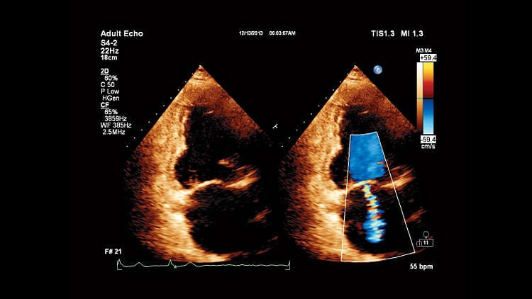 Philips Affiniti 30